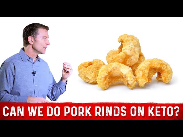 Best 5 Keto-Friendly Snack Options for a Guilt-Free 2025